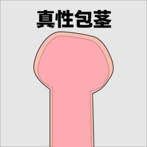 真性包茎のイメージ画像