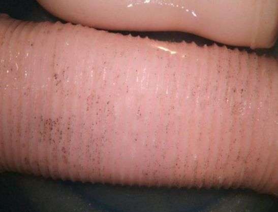 オナホのカビ画像